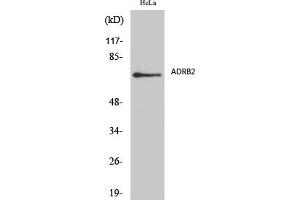 Western Blot analysis of various cells using AR-β2 Polyclonal Antibody diluted at 1:2000. (Androgen Receptor beta 2 Antikörper  (AA 180-260))