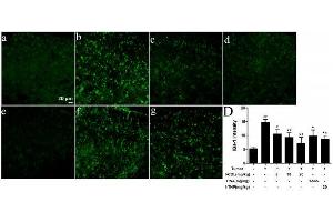 Immunohistochemistry (IHC) image for anti-Ionized Calcium-binding Adapter Molecule 1 (IBA1) (AA 51-147) antibody (ABIN685477)