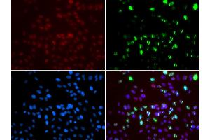 Immunofluorescence analysis of GFP-RNF168 trangenic U2OS cell using MSH6 antibody. (MSH6 Antikörper)