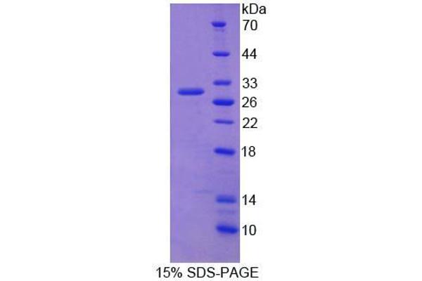 RRBP1 Protein