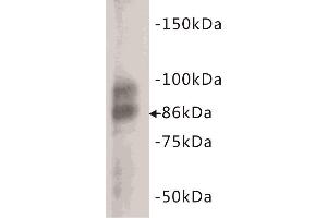 Western Blotting (WB) image for anti-Glycoprotein Hormones, alpha Polypeptide (CGA) (C-Term) antibody (ABIN1854868) (CGA Antikörper  (C-Term))