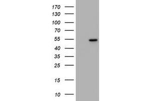 Image no. 1 for anti-Vimentin (VIM) antibody (ABIN1501719) (Vimentin Antikörper)