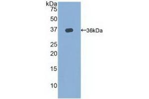 Detection of Recombinant TERT, Rat using Polyclonal Antibody to Telomerase Reverse Transcriptase (TERT) (TERT Antikörper  (AA 673-976))