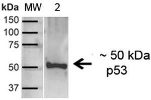 Western blot analysis of Human A431 showing detection of ~43. (p53 Antikörper  (C-Term) (HRP))