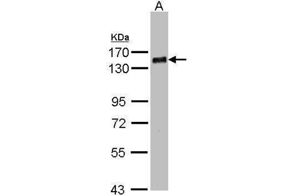 PHF20 Antikörper  (N-Term)