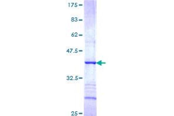 HAVCR1 Protein (AA 23-122) (GST tag)