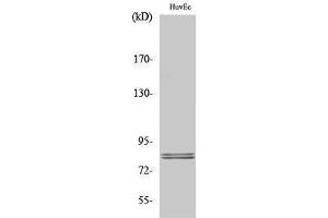 Western Blotting (WB) image for anti-Lipase, Hormone-Sensitive (LIPE) (Ser774) antibody (ABIN3175557) (LIPE Antikörper  (Ser774))