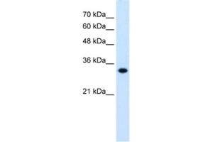 Western Blotting (WB) image for anti-3-Hydroxymethyl-3-Methylglutaryl-CoA Lyase (HMGCL) antibody (ABIN2462455) (HMGCL Antikörper)