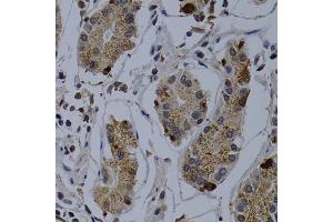 Immunohistochemistry of paraffin-embedded human stomach using TNFRSF6B antibody (ABIN5970241) at dilution of 1/200 (40x lens). (TNFRSF6B Antikörper)