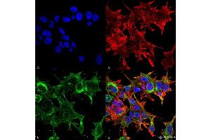 Immunocytochemistry/Immunofluorescence analysis using Mouse Anti-GFAP R416WT Monoclonal Antibody, Clone S206B-9 . (GFAP Antikörper  (AA 411-422) (PE))