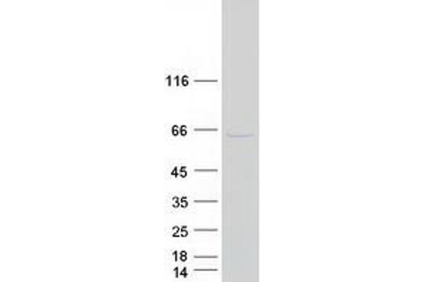 DCDC2 Protein (Myc-DYKDDDDK Tag)