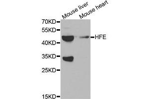 Western blot analysis of extracts of mouse brain and mouse heart tissues, using HFE antibody. (HFE Antikörper)