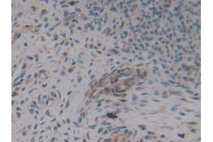 IHC-P analysis of Rat Uterus Tissue, with DAB staining. (AMH Antikörper  (AA 447-553))