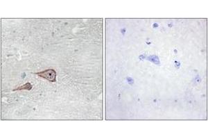 Immunohistochemistry analysis of paraffin-embedded human brain tissue, using CDH3 Antibody. (P-Cadherin Antikörper  (AA 51-100))