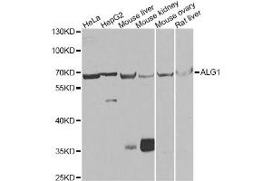 Western blot analysis of extracts of various cell lines, using ALG1 antibody (ABIN5975731) at 1/1000 dilution. (ALG1 Antikörper)