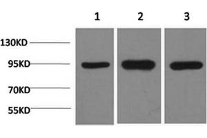 Western Blotting (WB) image for anti-Heat Shock Protein 90kDa alpha (Cytosolic), Class A Member 2 (HSP90AA2) antibody (ABIN5961311) (HSP90AA2 Antikörper)