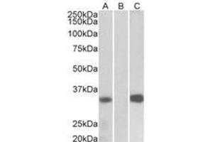 Image no. 1 for anti-Kv Channel Interacting Protein 3, Calsenilin (KCNIP3) (AA 21-31) antibody (ABIN1102701) (DREAM Antikörper  (AA 21-31))