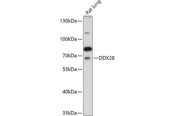 DDX28 Antikörper  (AA 371-540)