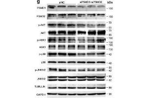 PSMD1 and PSMD2 regulate the expression level of fatty acids (FAs) and lipid synthesis-related genes. (MAPK14 Antikörper  (C-Term))