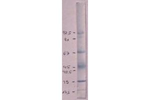 Immunoblot using anti-RSV-Hyperimmune Serum (Marker: Amidoblack) (Respiratory Syncytial Virus Long Strain (RSV Long) Antikörper)