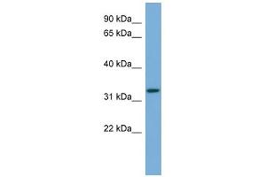 WB Suggested Anti-ATG3 Antibody Titration: 0. (ATG3 Antikörper  (Middle Region))