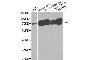 Western blot analysis of extracts of various cell lines, using ALB antibody (ABIN5970637) at 1/500 dilution. (Albumin Antikörper)