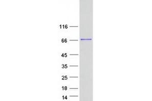 METTL3 Protein (Myc-DYKDDDDK Tag)