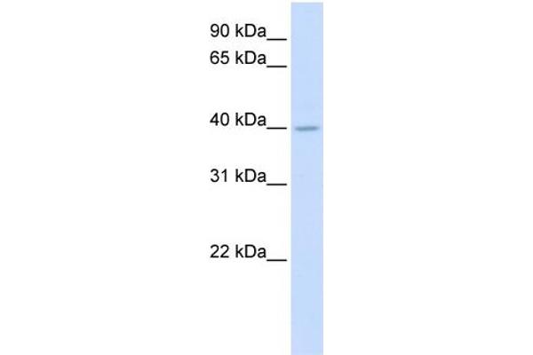 SRD5A3 Antikörper  (N-Term)