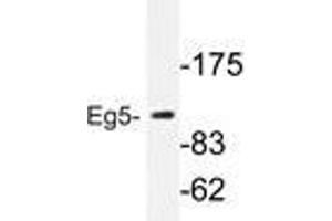Western blot analysis of Eg5 antibody in extracts from COLO205 cells. (KIF11 Antikörper)