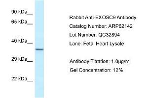 Western Blotting (WB) image for anti-Exosome Component 9 (EXOSC9) (N-Term) antibody (ABIN970651) (EXOSC9 Antikörper  (N-Term))