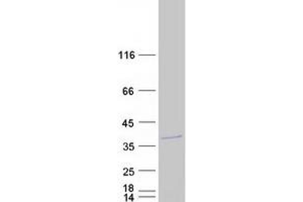 Histone H1.1 Protein (HIST1H1A) (Myc-DYKDDDDK Tag)