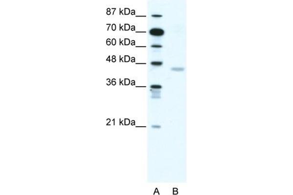 Cnpase Antikörper  (N-Term)