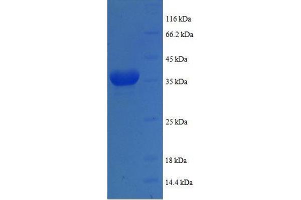 COX6A1 Protein (AA 25-109, full length) (GST tag)