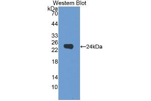 Western blot analysis of the recombinant protein. (Dermokine Antikörper  (AA 27-238))