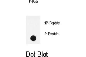 Dot Blot (DB) image for anti-LPR1 (pSer4520) antibody (ABIN3001761) (LPR1 (pSer4520) Antikörper)