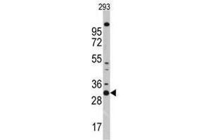 Image no. 1 for anti-Cyclin-Dependent Kinase 1 (CDK1) (N-Term) antibody (ABIN357035) (CDK1 Antikörper  (N-Term))