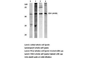 Western blot analysis of CD4 (pAla429) (CD4 Antikörper)