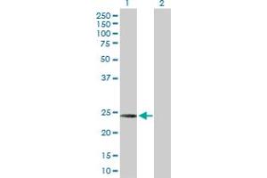 Western Blot analysis of C1QC expression in transfected 293T cell line by C1QC MaxPab polyclonal antibody. (C1QC Antikörper  (AA 1-245))