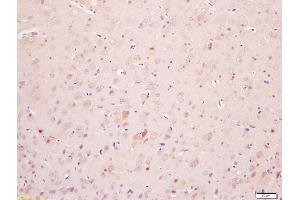 Formalin-fixed and paraffin embedded rat brain labeled with Anti-Phospho-MAPKAPK2(Ser272)Polyclonal Antibody, Unconjugated (ABIN710531) at 1:200, followed by conjugation to the secondary antibody and DAB staining (MAPKAP Kinase 2 Antikörper  (pSer272))