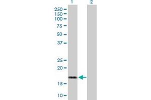 Western Blot analysis of DUSP22 expression in transfected 293T cell line by DUSP22 MaxPab polyclonal antibody. (DUSP22 Antikörper  (AA 1-184))