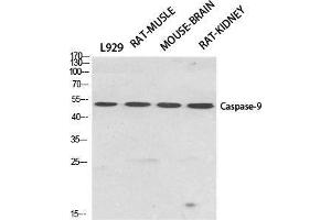 Western Blot (WB) analysis of specific cells using Caspase-9 Polyclonal Antibody. (Caspase 9 Antikörper  (Ser20))