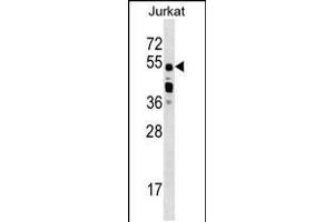 Western blot analysis in Jurkat cell line lysates (35ug/lane). (CELF2 Antikörper  (C-Term))