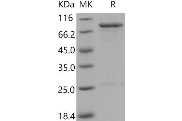 OXSR1 Protein (GST tag)