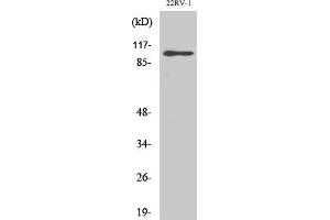 Western Blot analysis of various cells using GluR-2 Polyclonal Antibody. (GRIA2 Antikörper)