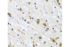 Immunohistochemistry of paraffin-embedded Rat brain using HDAC4 Polyclonal Antibody at dilution of 1:100 (40x lens). (HDAC4 Antikörper)