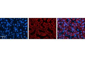 CTAGE5 antibody - middle region          Formalin Fixed Paraffin Embedded Tissue:  Human Liver Tissue    Observed Staining:  Cytoplasm in hepatocytes   Primary Antibody Concentration:  1:600    Secondary Antibody:  Donkey anti-Rabbit-Cy3    Secondary Antibody Concentration:  1:200    Magnification:  20X    Exposure Time:  0. (MIA2 Antikörper  (Middle Region))