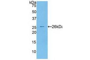 Western blot analysis of recombinant Human CTSS. (Cathepsin S Antikörper  (AA 115-331))