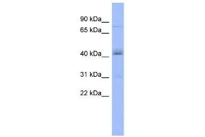 WB Suggested Anti-PAPOLB Antibody Titration:  0. (PAPOLB Antikörper  (Middle Region))