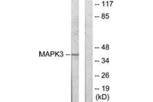 Western blot analysis of extracts from COLO205 cells, using MAPK3 Antibody. (ERK1 Antikörper  (AA 301-350))