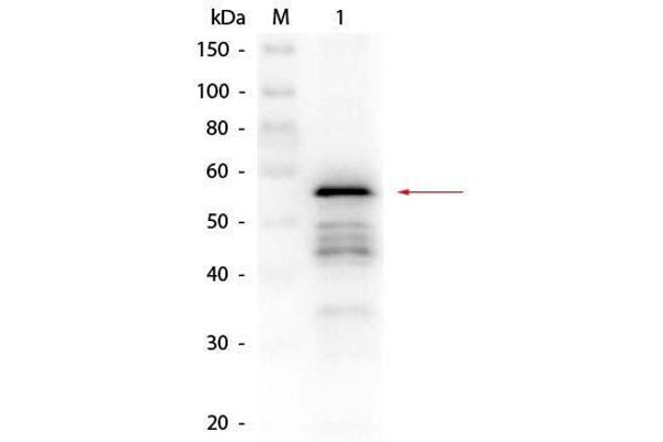 Aldehyde Dehydrogenase Antikörper